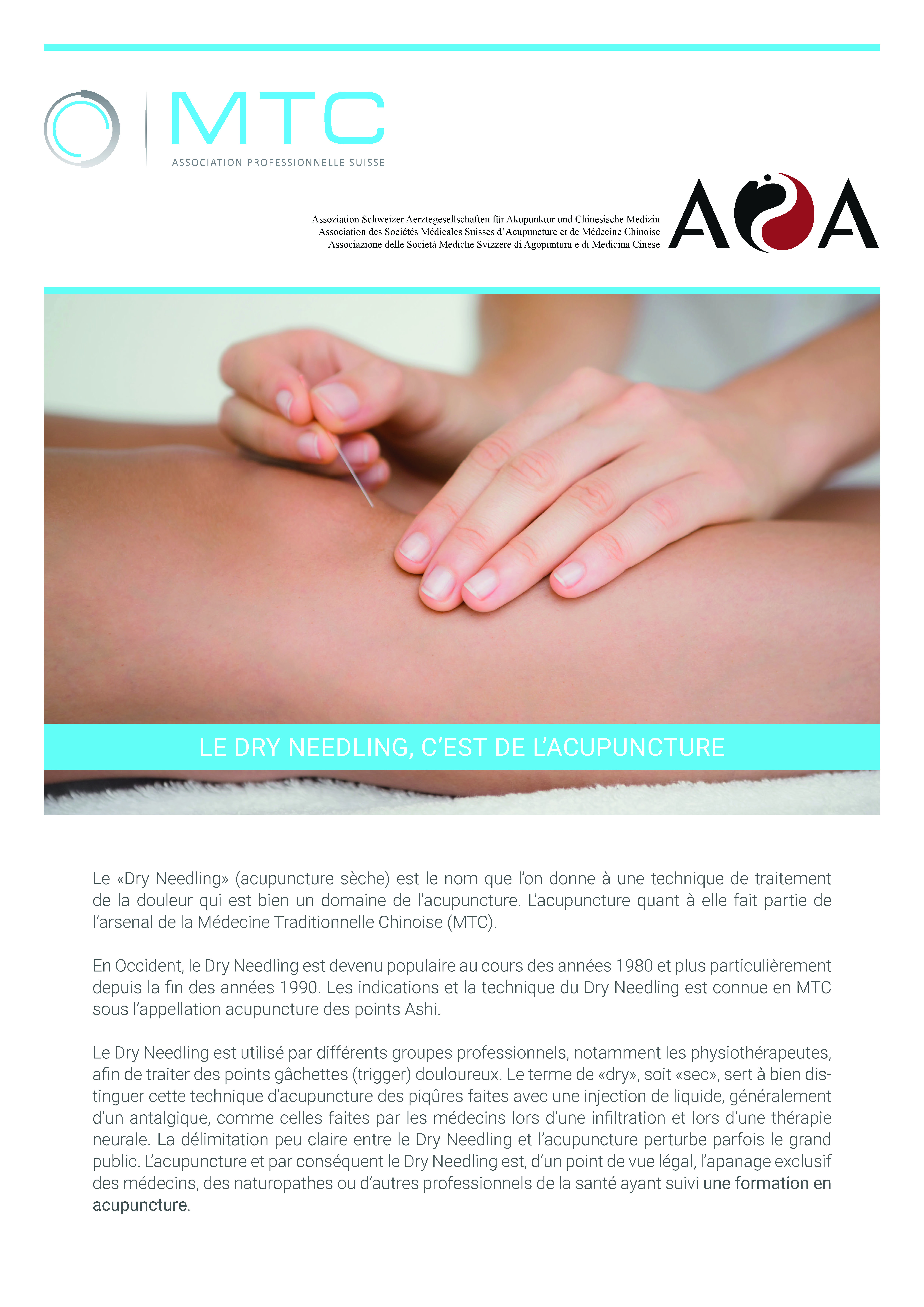 Brochure: Le Dry Needling, C’est De L’acupuncture